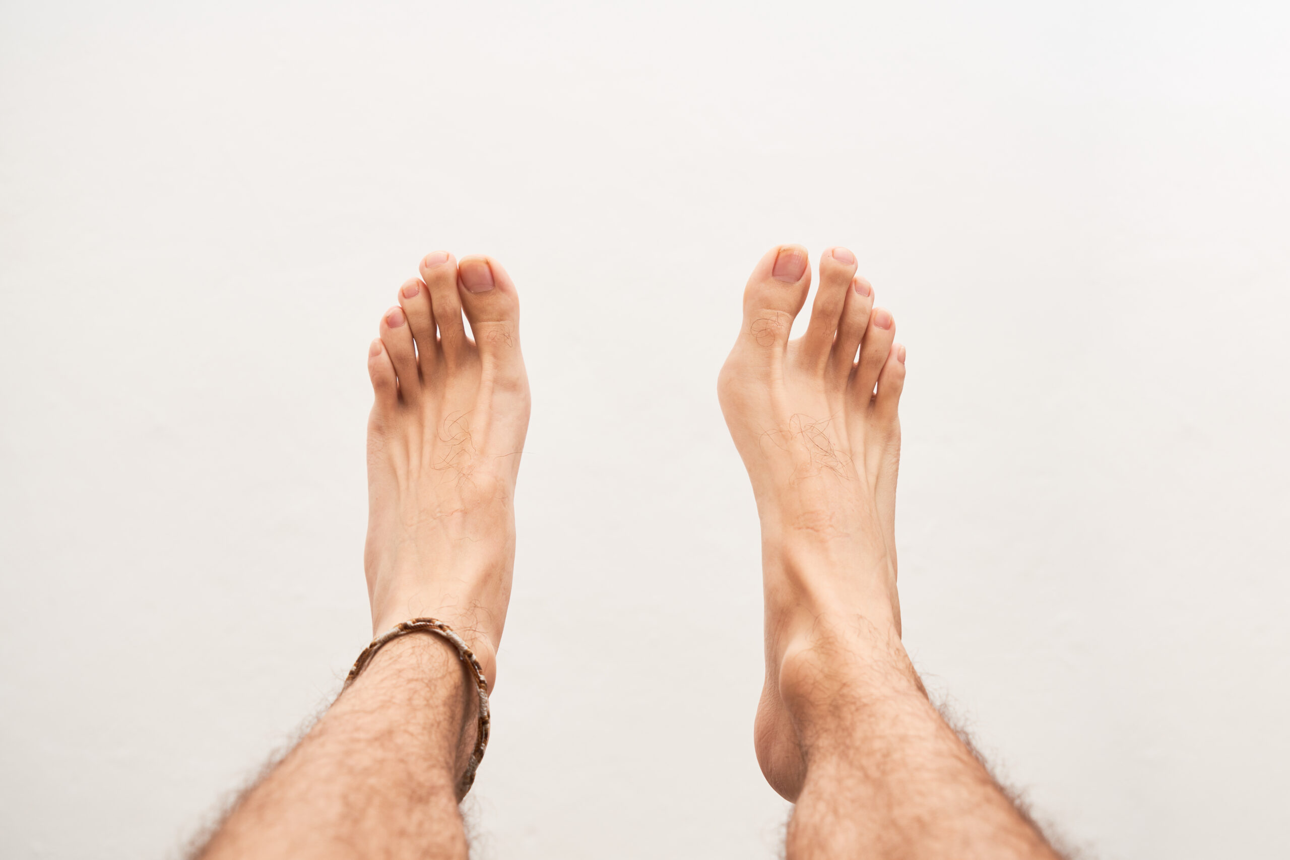 Understanding Bunion Deformity: Causes, Symptoms, and Treatment Options 